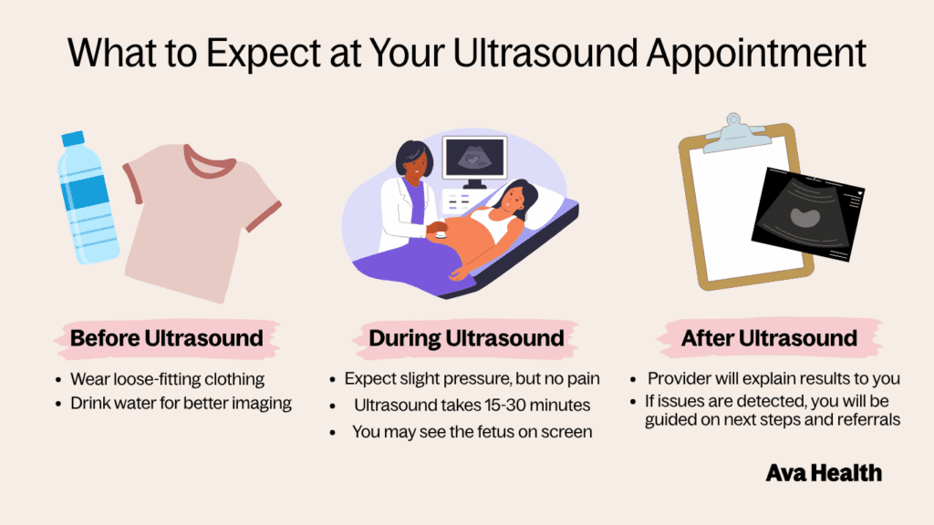 a graphic detailing what to expect at an ultrasound appointment