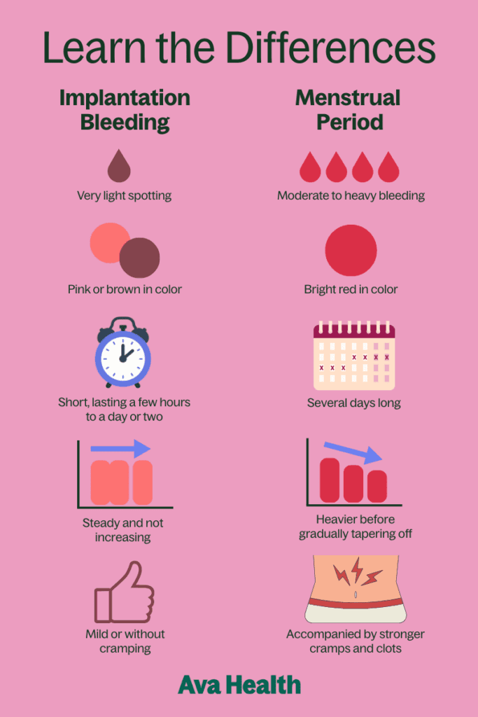 A chart showing the differences between implantation bleeding and a period
